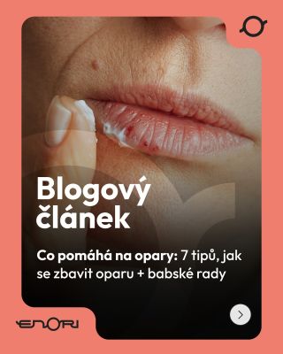 Objeví se vždy, když se to nejmíň hodí ….stres, únava, slunce…a opar je tu. 🦠 Za jeho vznikem stojí virus HSV-1, ale s...